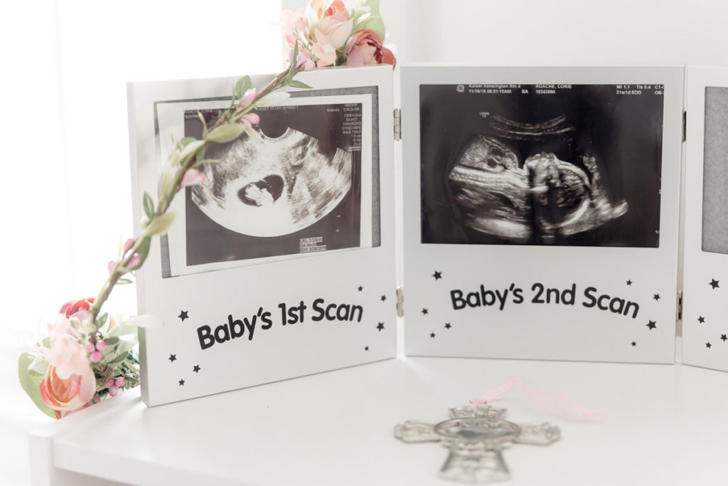 baby's first scan, nursery details
