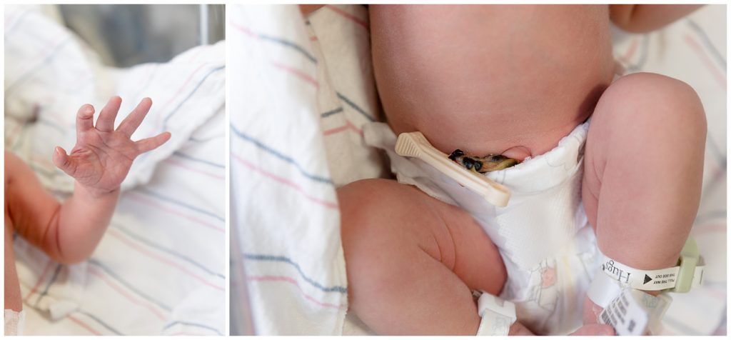 newborn photos in the hospital show umbilical cord