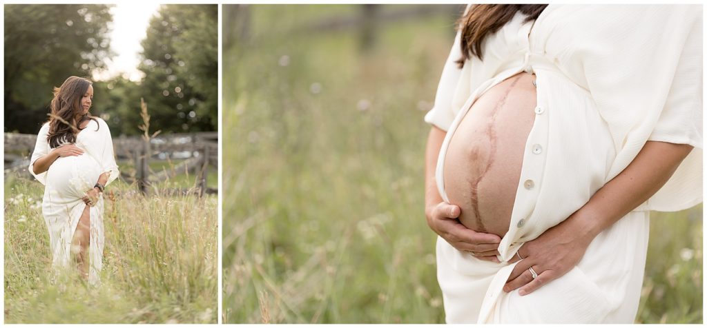 pregnant mom wears white open-belly dress to show birth scars